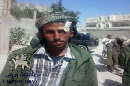 شهيد شبوه  &lsquo;&lsquo;محمد أحمد سالم العبدلي العولقي&lsquo;&lsquo; حي يرزق