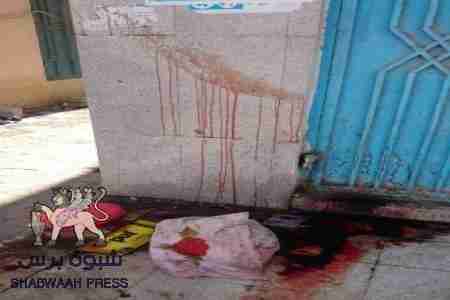 مقتل جندي يمني على يد زملائه العسكريين رغم تعريفه لهم بهويته