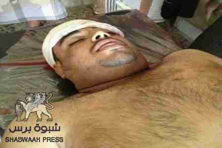 دعوة عامة للمشاركة في تشييع جنازة الشهيد محمد فيصل بن حسن بعتق صباح الغد