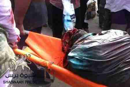 مصدر طبي لقناة الحدث : عشرات القتلى والجرحى في قصف للجيش اليمني على مخيم عزاء في الضالع