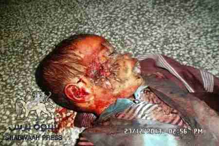 الرئيس هادي يوجه بتكليف لجنة تحيقيق في مذبحة الضالع ( صور بشعة جدا )