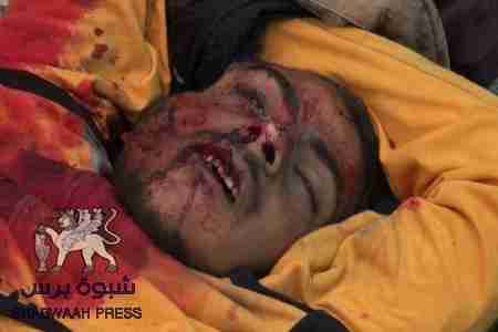 بيان ائتلاف قوى الثورة السلمية الجنوبية بشأن مجزرة الضالع