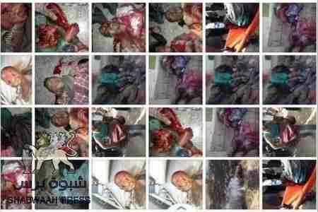 ناشط حقوقي جنوبي: ما حدث في الضالع جريمة حرب ضد الانسانية وهي لا تسقط بالتقادم