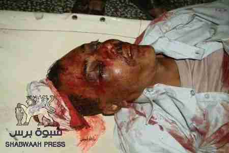 الاصنج: جريمة &lsquo;&lsquo;الضالع&lsquo;&lsquo; لا يمكن لها أن تمر ولن نقبل السكوت أو التغاضي عنه