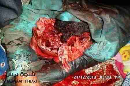 الشيخ بن عبدالواحد يدين مجزرة الضالع ويطالب بمحاكة القتلة امام محكمة الجنايات الدولية