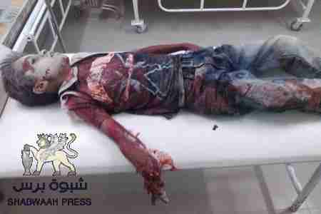 شبوه برس: ينشر صور الشهداء الطفل بلبحيث والشاب الدابسي العولقي (صور بشعة)