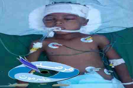 مرصد حضرموت: بيانات الطفل عبدالرحمن اليميني ,العمر 7 سنوات الذي قتل برصاص الجيش اليمني