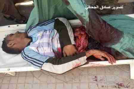 استشهاد مواطنين بايدي قوات اللواء 33 بالضالع