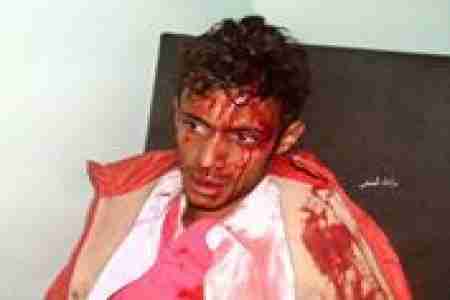 عاجل :سقوط 7جرحى في قصف مدفعي طال مرافق ومنازل في مدينة الضالع بينها المستشفى الدولي لمنظمة أطباء بلا حدود