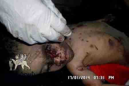 من الضالع يعاد سيناريو الحرب على الجنوب