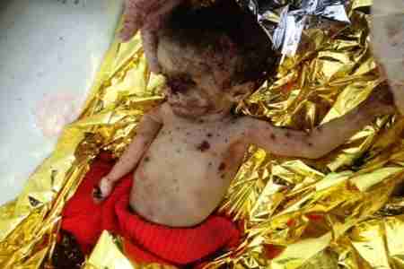 حزب الرابطة يدين جرائم الجيش اليمني في الضالع ويقول أنها تزيد حالة العداء