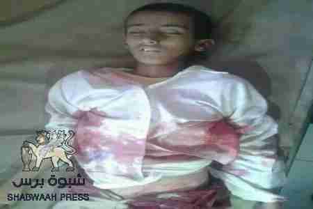 استشهاد الطفل عبداللاه عبدالكريم ناصر في الضالع