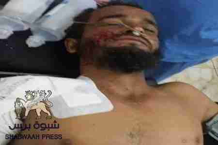 الجريح ياسين علي حسن فقد زوجته وبناته وحين أفاق سأل عنهن