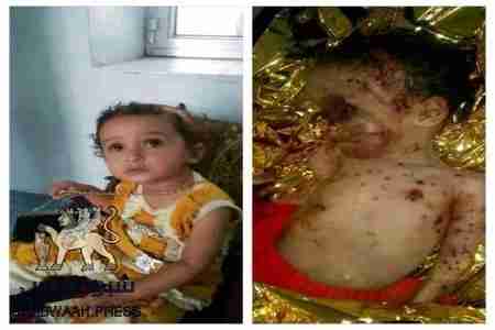 سياسي يمني يوجه رسائل عتاب لقنوات وصحف شمالية لتجاهلها ما يحدث في الضالع