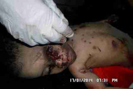 اللواء 33مدرع يقصف منطقة زبيد - الضالع بقذيفتين من مدفعية 160.