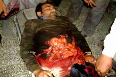 عناصر قبلية تأسر أربعة جنود يمنيين في الضالع