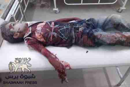 سلطة شبوه تدفع 15 مليون ريال ثمنا لدماء الطفل بشار بلبحيث