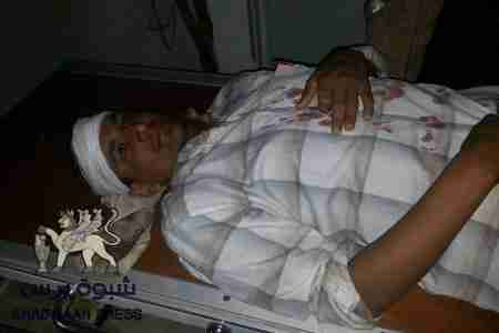 سقوط جريحين حتى الان في اطلاق الأمن اليمني النار على المتظاهرين في عتق