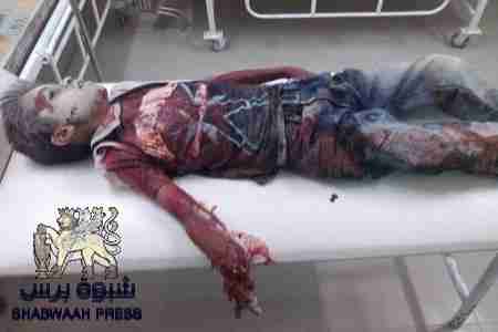 زوامل متبادلة حول جريمة قتل الطفل بشار بلبحيث بين سلطة شبوه ومواطنين