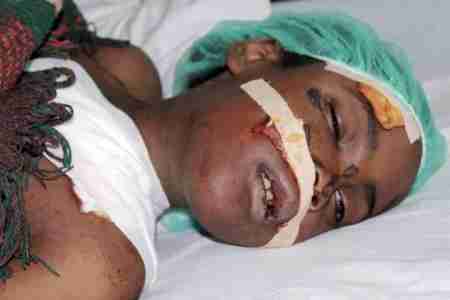 يمني أبيض يصدم طفلة سوداء أجبره من في الشارع على اسعافها فرماها في الشارع الثاني