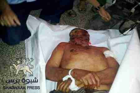 شهيد وجرحى في الضالع وتوتر للوضع