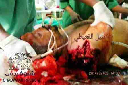 سقوط شهيد برصاص الدوشكا في منصورة عدن واقتحام لساحة الشهداء