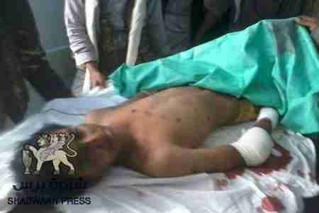 اصابة شابين في انفجار جسم غريب على طريق نصاب عتق و&lsquo;&lsquo; شبوه برس&lsquo;&lsquo; يحذر المواطنين