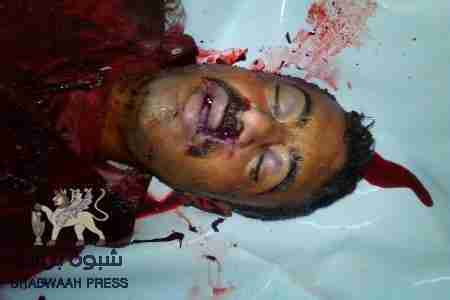 العثور على جثة شخص مقتولاً عقب قصف الجيش على الضالع