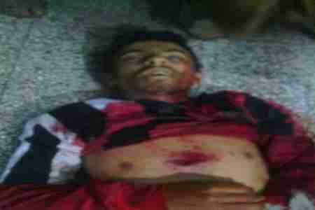 سقوط شهيدين في الضالع ومقتل ضابط وجندي في تجدد لقصف اللواء33 لمنازل المواطنين