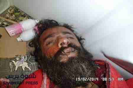 قوات ضبعان تعدم ثلاثة أسرى جنوبيين وتلقي جثثهم في الخلاء (صور)