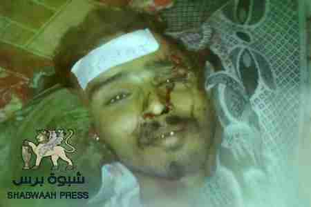 منظمة حقوقية في تقريرها : الجيش اليمني يرتكب جرائم حرب في جنوب اليمن