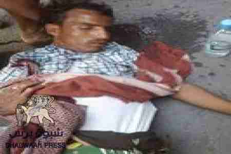 سقوط جرحى في ساحة العروض وجولة الثقافة جراء رصاص الأمن اليمني