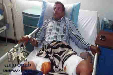 عيدروس لقور (البوهي): ذهبت لكي اوقف عمل المتنفذين بأرضنا فحاولوا قتلي واصبت بأربع طلقات