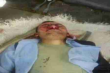 استمرار للظاهرة المرعبة : العثور على جثة شخص مقتولاً في سوق مدينة الضالع