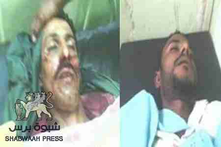 الحركة الشبابية والطلابية لتحرير واستقلال الجنوب تنعي الشهيد احمد لقور العولقي رئيس الدائرة التنظيمية بمحافظة لحج