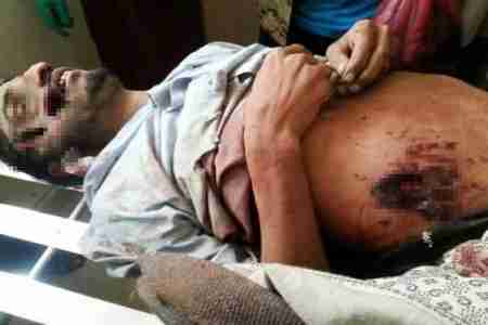 عناصر مجهولة تتخطف نائب حراك جدعاء ردفان وترميه في ضاحية الحبيلين وحالته الصحية حرجه