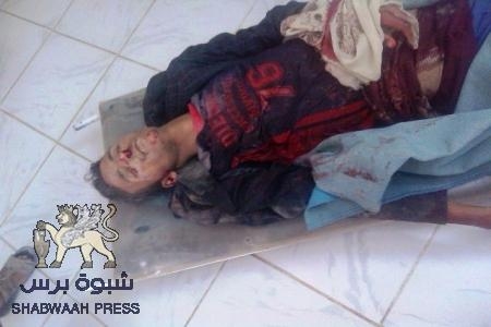 عاجل : مقتل جندي يمني في مدينة القطن من قبل مجهولين