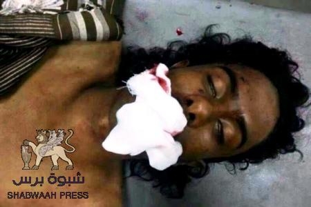 الجيش اليمني يقتل الشهيد مبارك معوض العولقي فجر اليوم في المنصورة