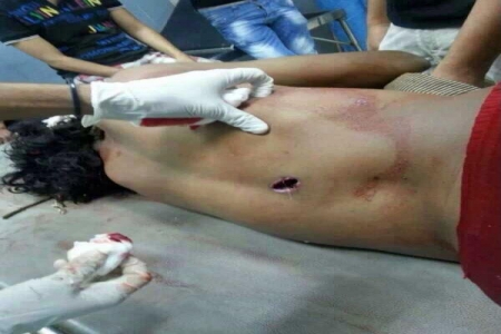 القتل أولاً ثم البحث للضحية عن تهمة ! مبارك العولقي نموذج صارخ