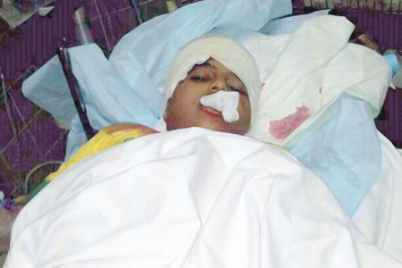 أطباء عدن ينجحون في استئصال كيس صديد يزن ربع كجم من رأٍس طفل