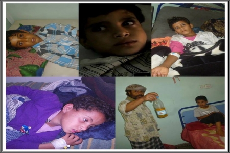 آفاق تدعو المنظمات الدولية إلى ايفاد لجنة طوارئ عاجلة إلى الضالع  لتقصي الحقائق حول انتشار وباء مرض &lsquo;&lsquo;أنيما الفول&lsquo;&lsquo;