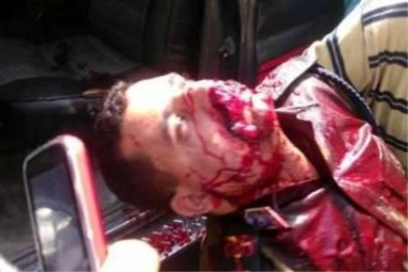 مقتل ضابط أمن في شرطة لحج قبل قليل