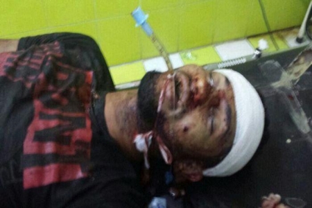 مقتل شاب في عدن بالرصاص ودهسا بسيارة الأمن