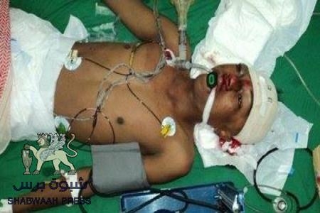 يوم القتل الرعب والعبث من قوات الاحتلال في المكلا واستهداف الممتلكات الخاصة بالنهب والتدمير (صور)