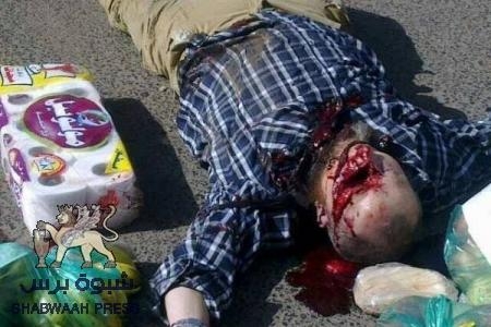 مقتل دبلوماسيان فرنسيان واصابة الثالث في صنعاء