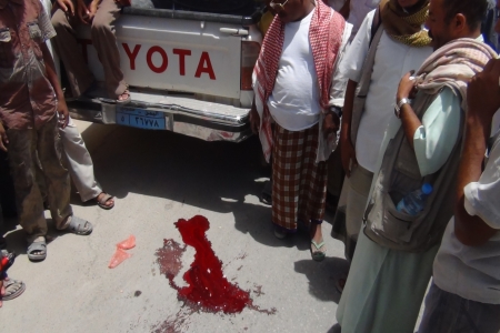 إنهيار الهدنة : تقرير اخباري في تلفزيون صنعاء يشعل الحرب مجددا في مأرب