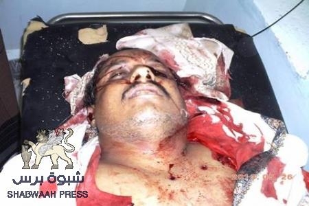 أغتيال عاقل حارة في حوطة لحج