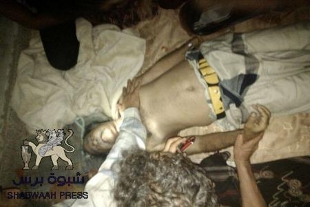 عندما يفقد النظام إنسانيته .. وفاة سجين في الضالع ورفض علاج آخرين