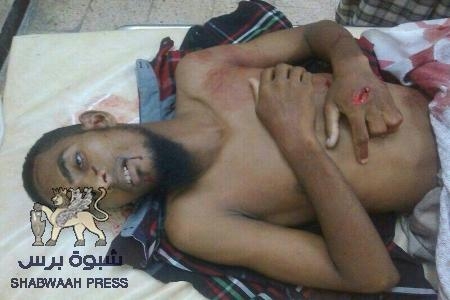 أغتيال عماد سالم جوبح الحارس الشخصي لمأمور الشحر احمد مدي عند مقهى مقسومه في منتصف الليل (صور)