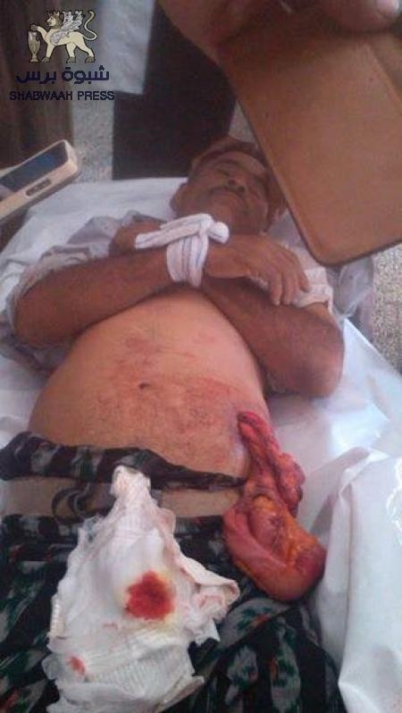 منظمة حقوقية : ما يحدث في الضالع من جرائم حرب ضد المدنيين وصمة عار في سجلات حقوق الانسان